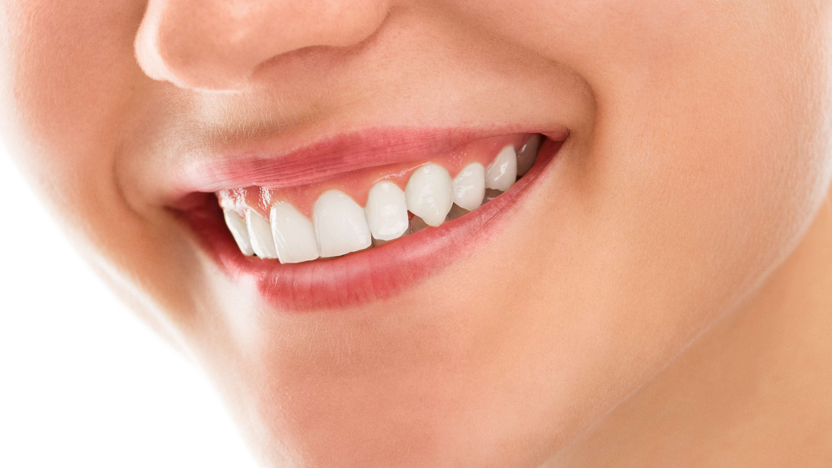 Cosmetic Dentistry