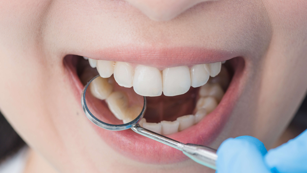 Enhancing Your Smile: Expert Dental Care to Achieve Radiant Results