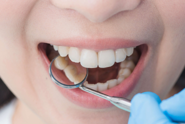 Enhancing Your Smile: Expert Dental Care to Achieve Radiant Results