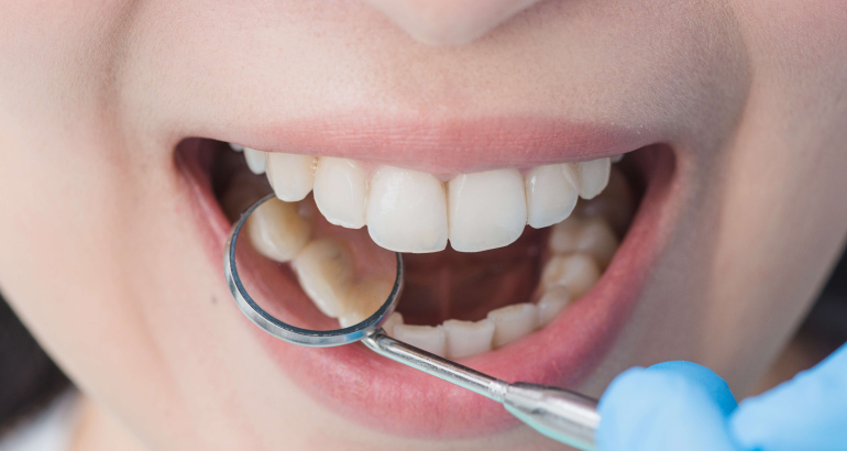 Enhancing Your Smile: Expert Dental Care to Achieve Radiant Results