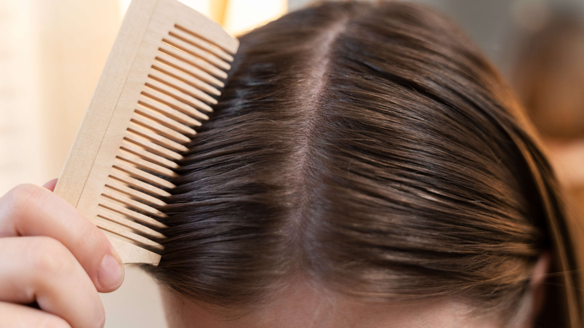Scalp micropigmentation
