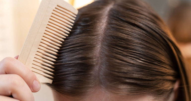 Scalp micropigmentation