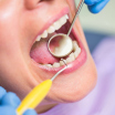 Common Oral Health Problems That May Require tooth removal