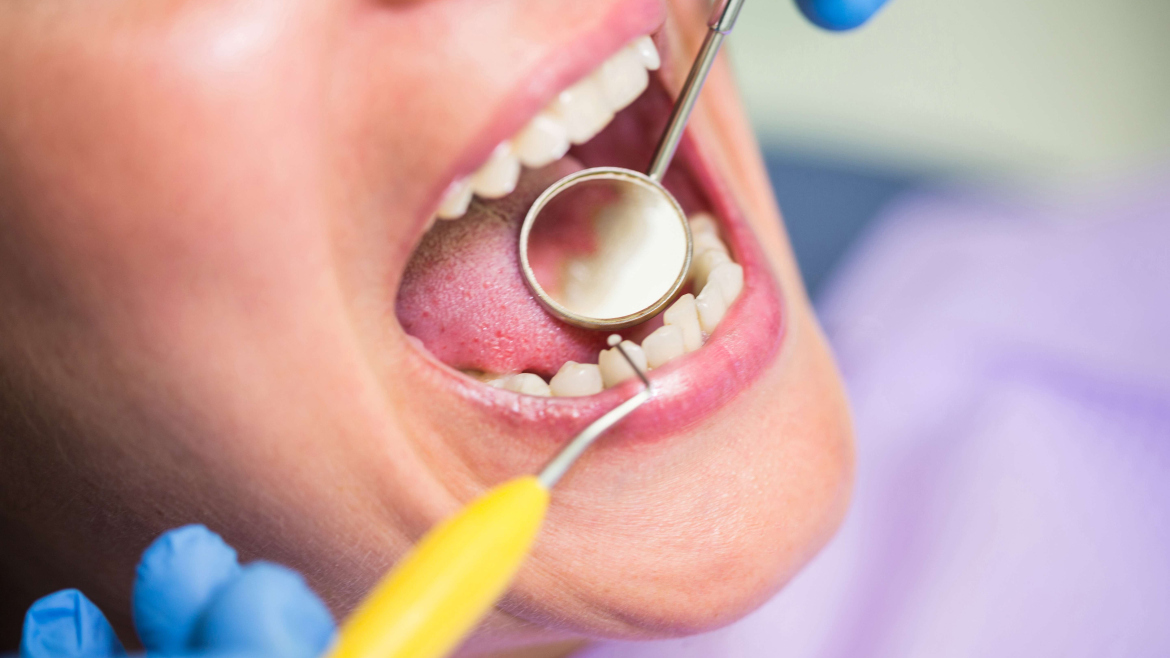 Implant Dentistry