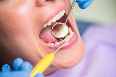 Common Oral Health Problems That May Require tooth removal