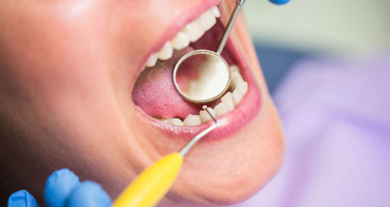 Implant Dentistry