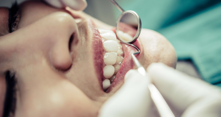 oral surgery