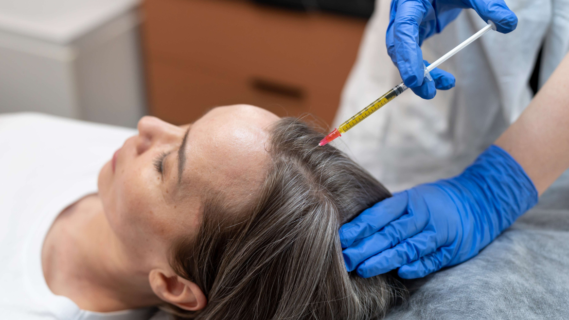 PRP therapy for hair growth