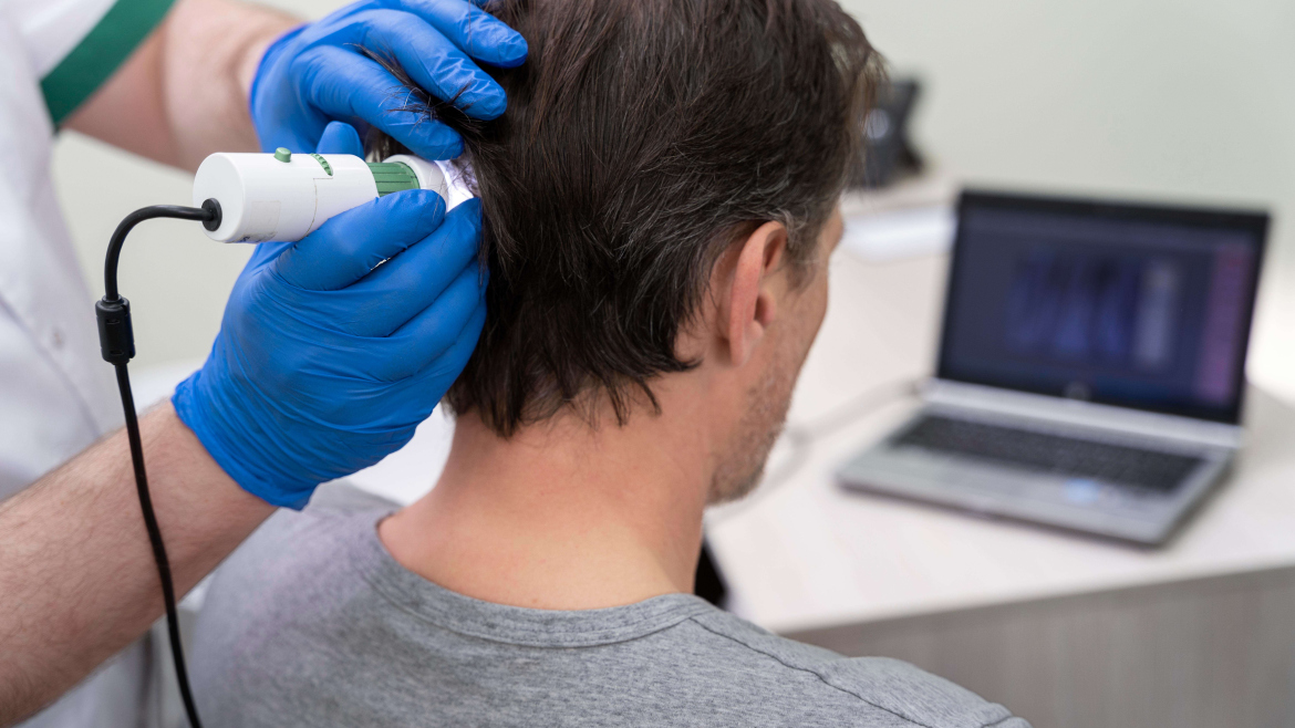 Hair loss treatment